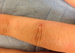 finger2